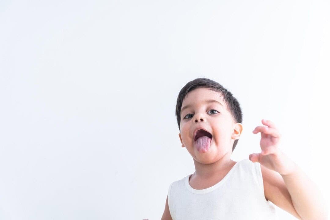 Cắt thắng lưỡi cho trẻ